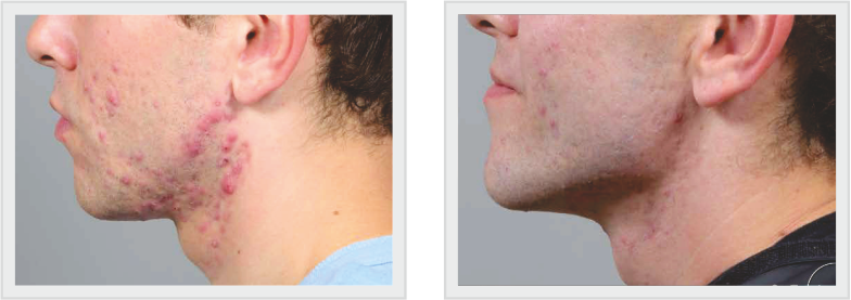 BEFORE N AFTER-1 (1)