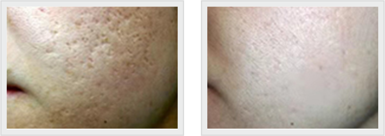 BEFORE N AFTER-2 (2)